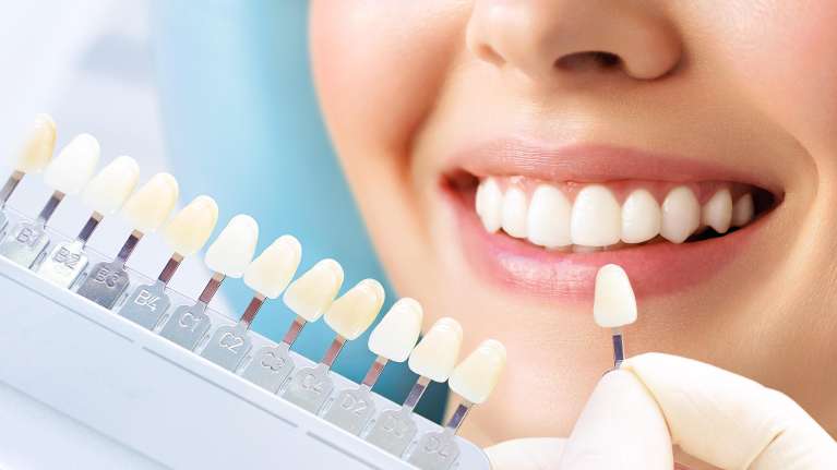 woman getting teeth whitening in doreen